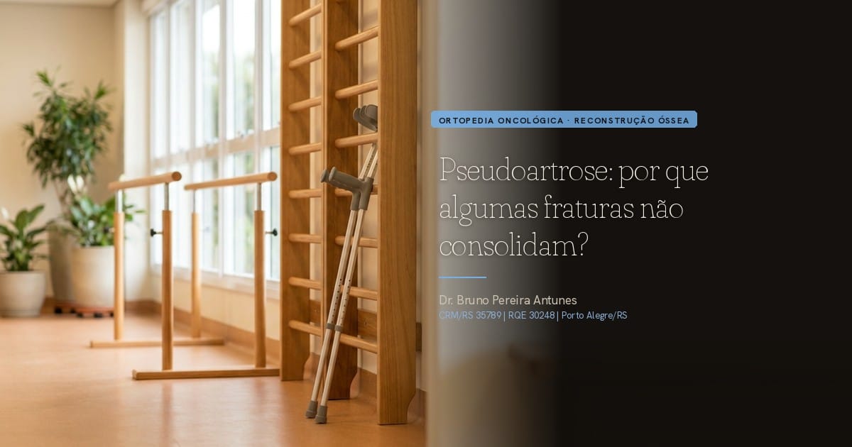 Pseudoartrose: por que algumas fraturas não consolidam?