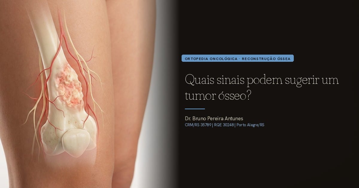 Quais sinais podem sugerir um tumor ósseo?