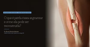 O que é perda óssea segmentar e como ela pode ser reconstruída?