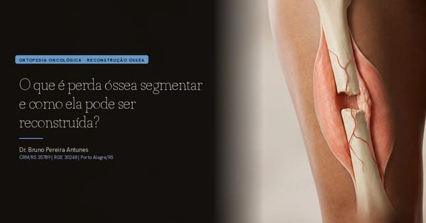 O que é perda óssea segmentar e como ela pode ser reconstruída?