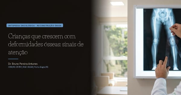 Crianças que crescem com deformidades ósseas: sinais de atenção